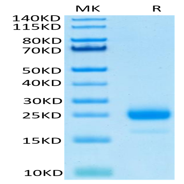 Human IL-4 Protein (IL4-HM401)