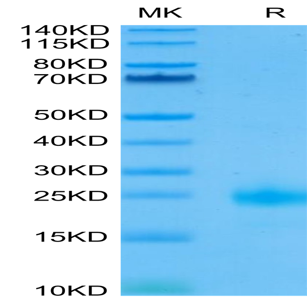 Biotinylated Human IL-4 Protein (IL4-HM401B)