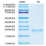Cynomolgus IL-5 Protein (IL5-CM101)