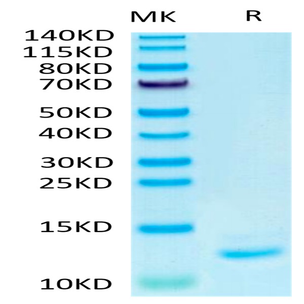 Human IL-15 Protein (IL5-HE015)