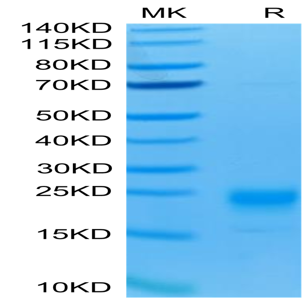Human IL-5 Protein (IL5-HM401)