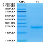 Biotinylated Human IL-5 Protein (IL5-HM401B)