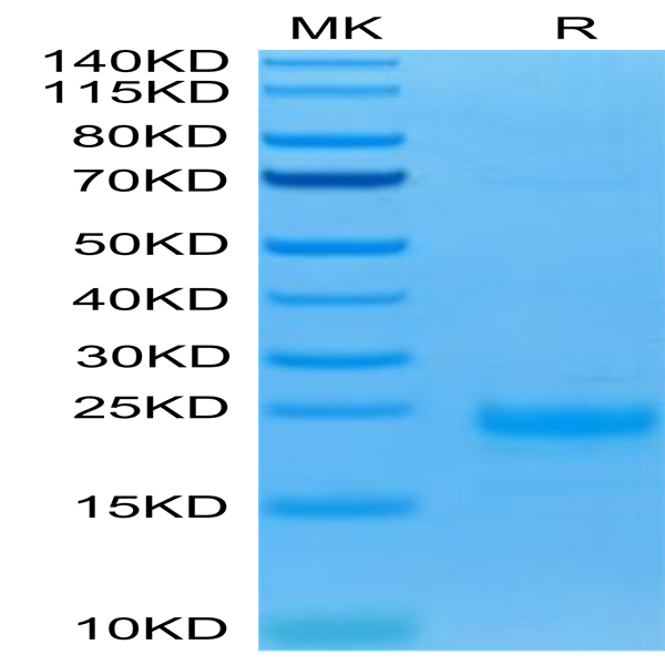 Biotinylated Human IL-5 Protein (IL5-HM401B)