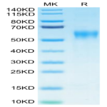 Biotinylated Human IL-15RA/IL-15 R alpha/CD215 Protein (IL5-HM4RAB)