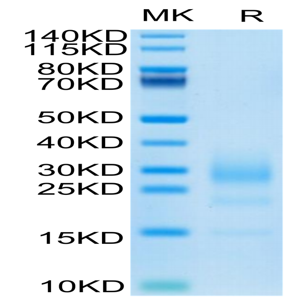 Mouse IL-5 Protein (IL5-MM401)