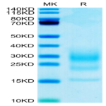 Biotinylated Mouse IL-5 Protein (IL5-MM401B)