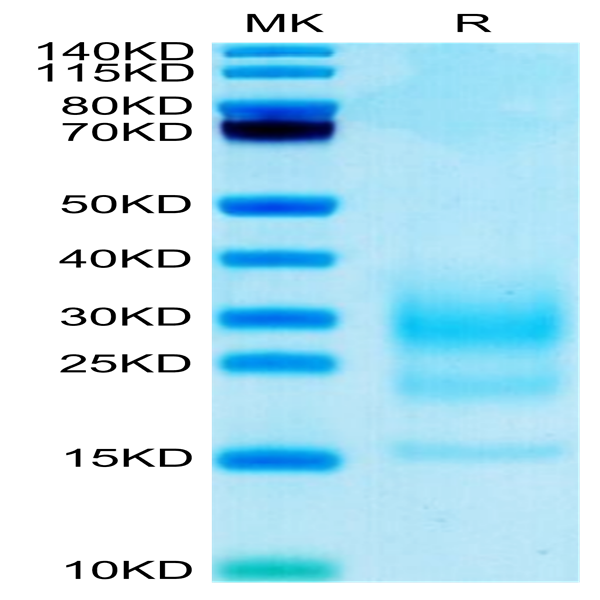 Biotinylated Mouse IL-5 Protein (IL5-MM401B)