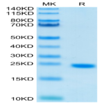 Human IL-6 Protein (IL6-HE001)