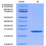 Human IL-37 Protein (IL7-HE037)