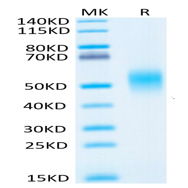 Human IL-7R alpha/CD127 Protein (IL7-HM1RA)