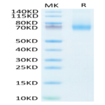 Human IL-7R alpha/CD127 Protein (IL7-HM2RA)