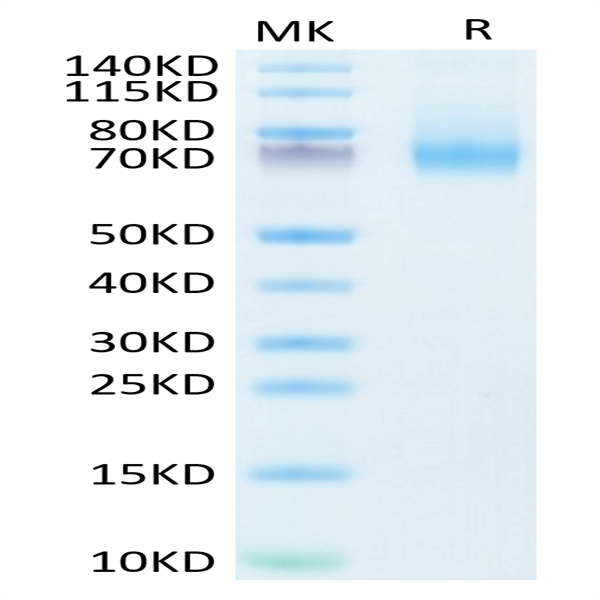 Human IL-7R alpha/CD127 Protein (IL7-HM2RA)