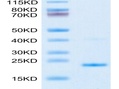 Mouse IL-17B Protein (IL7-ME17B)