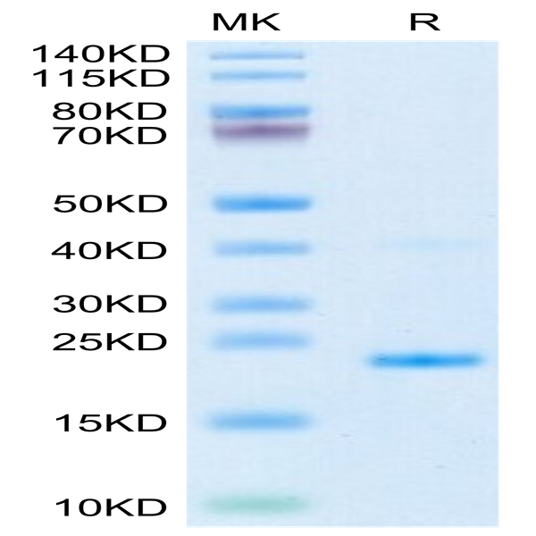 Mouse IL-17B Protein (IL7-ME17B) Mouse IL-17B Protein (IL7-ME17B)
