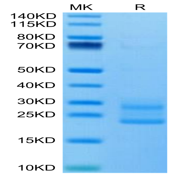 Mouse IL-17A&F Protein (IL7-MM4AF)