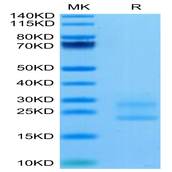 Biotinylated Mouse IL-17A&F Protein (IL7-MM4AFB)