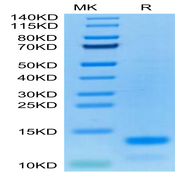 Cynomolgus IL-8/CXCL8 Protein (IL8-CM108)