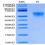 Biotinylated Cynomolgus IL-18BP Protein (Primary Amine Labeling) (IL8-CM1BPB)