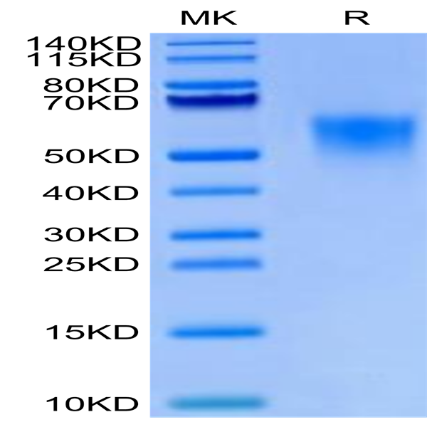 Biotinylated Cynomolgus IL-18BP Protein (Primary Amine Labeling) (IL8-CM1BPB)