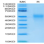 Human IL-18BP Protein (IL8-HM1BP)