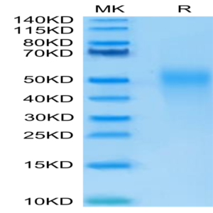 Human IL-18BP Protein (IL8-HM1BP)