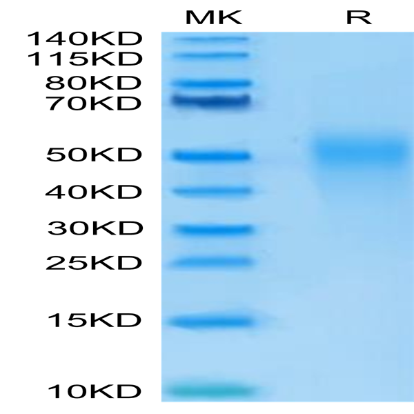 Human IL-18BP Protein (IL8-HM1BP)