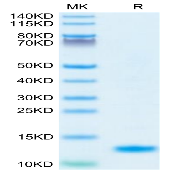 Human IL-8/CXCL8 Protein (IL8-HM1RA)