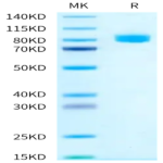 Human IL-18 R1/CD218a Protein (IL8-HM2R1)