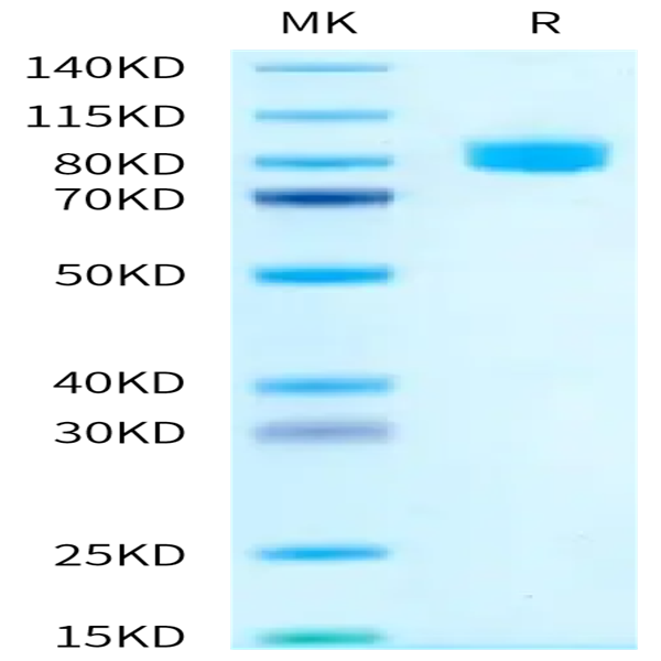 Human IL-18 R1/CD218a Protein (IL8-HM2R1)