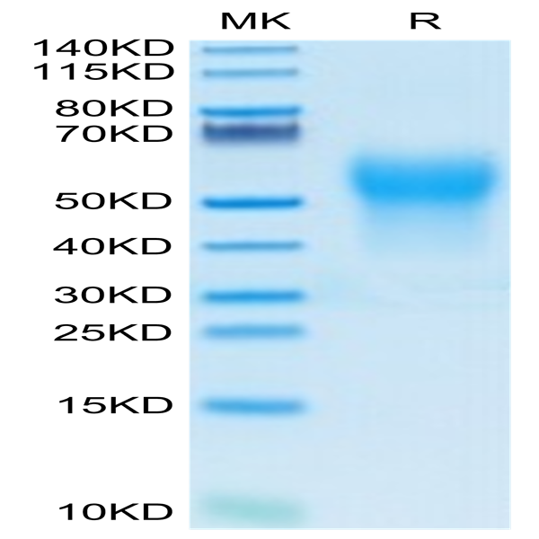 Biotinylated Human IL-18BP Protein (IL8-HM4BPB)