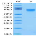Human IL-18 R1/CD218a Protein (IL8-HM4R1)