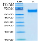 Biotinylated Human IL-18 R1/CD218a Protein (IL8-HM4R1B)