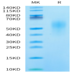 Mouse IL-18BP Protein (IL8-MM1BP)