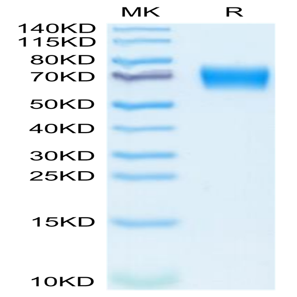 Mouse IL-18 R1/CD218a Protein (IL8-MM1R1)