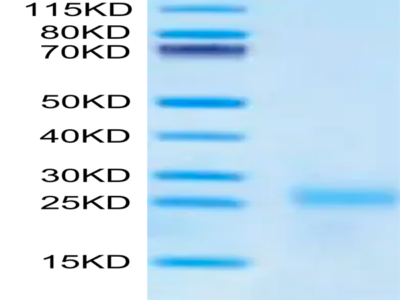 Cynomolgus IL-9 Protein (IL9-CM101)