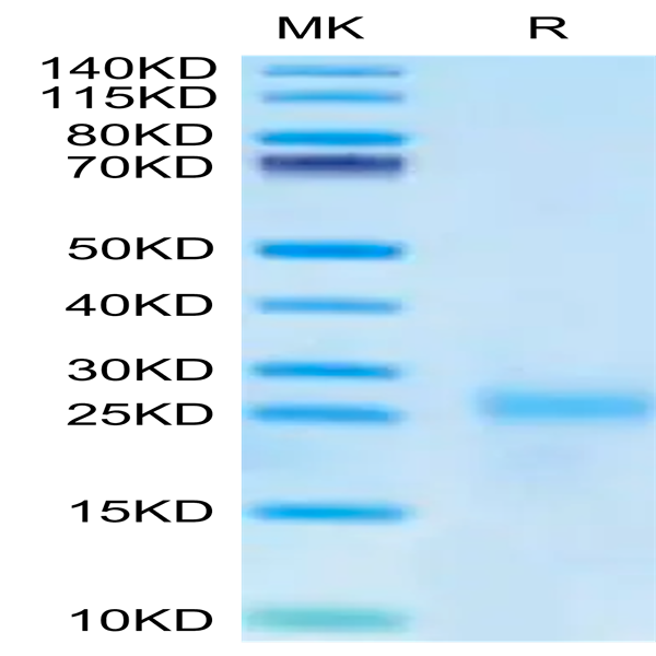 Cynomolgus IL-9 Protein (IL9-CM101) Cynomolgus IL-9 Protein (IL9-CM101)