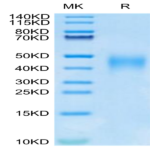 Human IL-9 Protein (IL9-HM101)