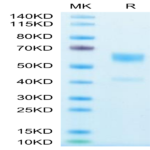 Human IL-9 Protein (IL9-HM201)