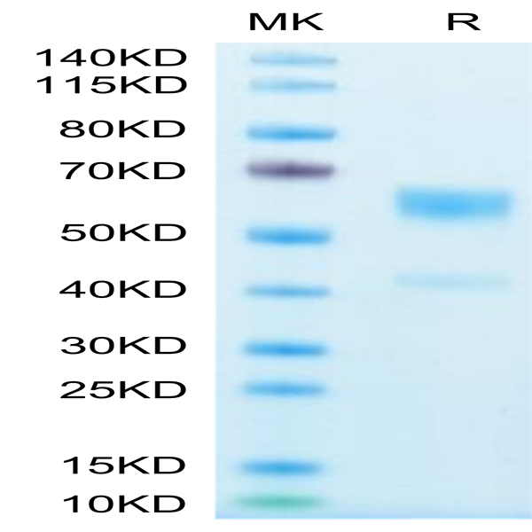 Human IL-9 Protein (IL9-HM201)