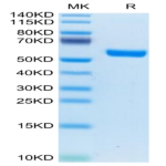 Human IL-19 Protein (IL9-HM219)