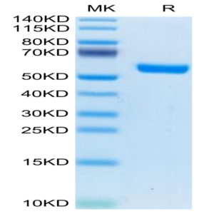 Human IL-19 Protein (IL9-HM219)