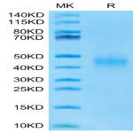 Mouse IL-9 Protein (IL9-MM101)