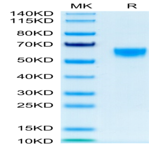 Mouse IL-9 Protein (IL9-MM201)