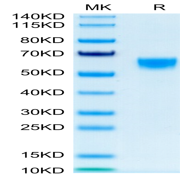 Mouse IL-9 Protein (IL9-MM201)