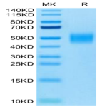 Cynomolgus IL-4 R alpha/CD124 Protein (ILA-CM14R)