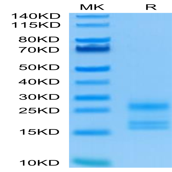 Human IL-17A/CTLA-8 Protein (ILA-HM118)