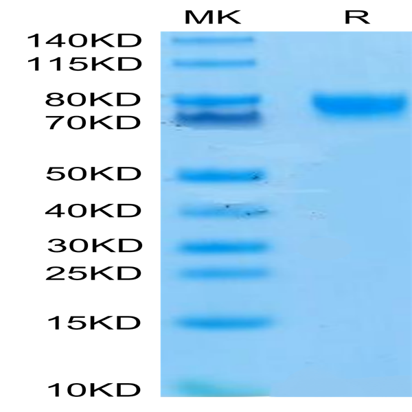 Human IL-4 R alpha/CD124 Protein (ILA-HM24R)
