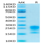 Biotinylated Human IL-17A/CTLA-8 Protein (ILA-HM418B)