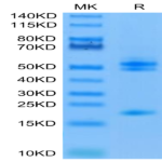 Human IL-23 alpha&Mouse IL-12 beta Protein (ILB-HM4AB)