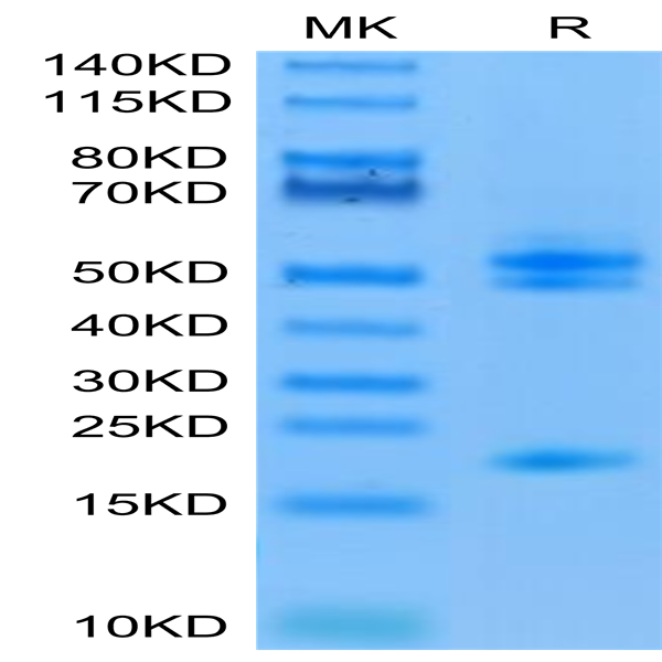 Human IL-23 alpha&Mouse IL-12 beta Protein (ILB-HM4AB)